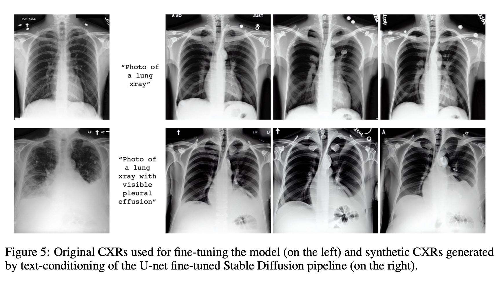  図2：モデルの微調整に用いたオリジナルのCXR（左）と、U-netで微調整したStable Diffusionパイプラインのテキストコンディショニングにより生成された合成CXR（右）。