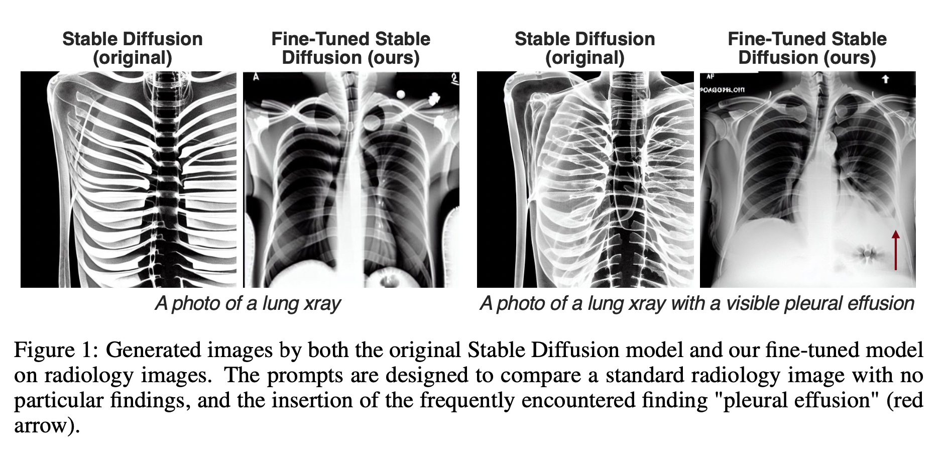 図1：放射線画像におけるオリジナルの安定拡散モデルと研究チームが微調整したモデルによる生成画像。プロンプトは、特に所見のない標準的な放射線画像と、頻繁に遭遇する所見である「胸水」（赤矢印）を挿入して比較するように設計されている。