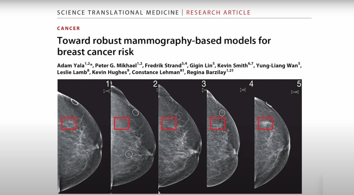 人種間で公平に動作する乳がん予測AI、MITが開発